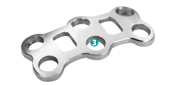 Placca di osteosintesi